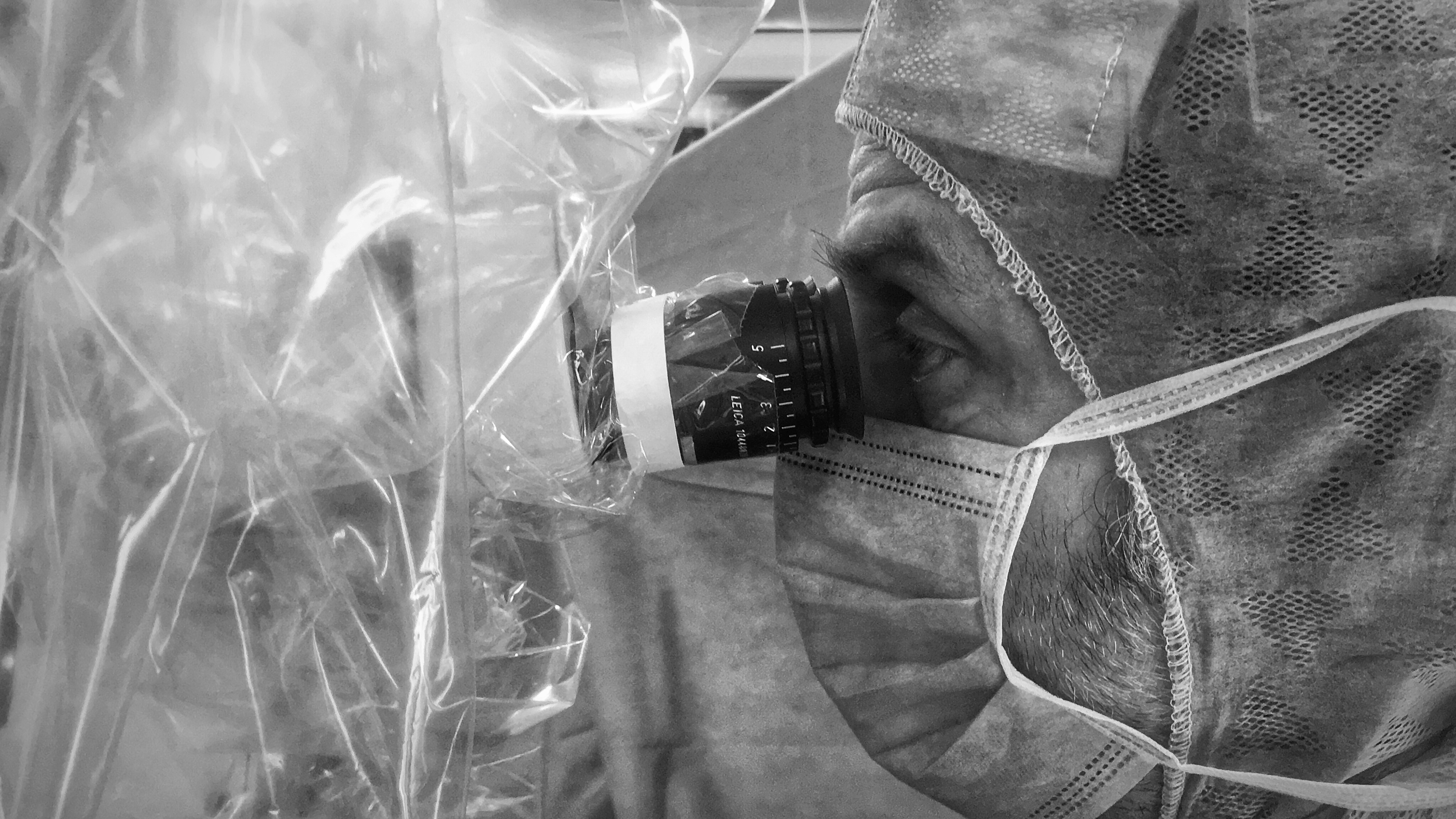 Reimpiantato un dito a una bimba di 18 mesi all’ASST Gaetano Pini-CTO