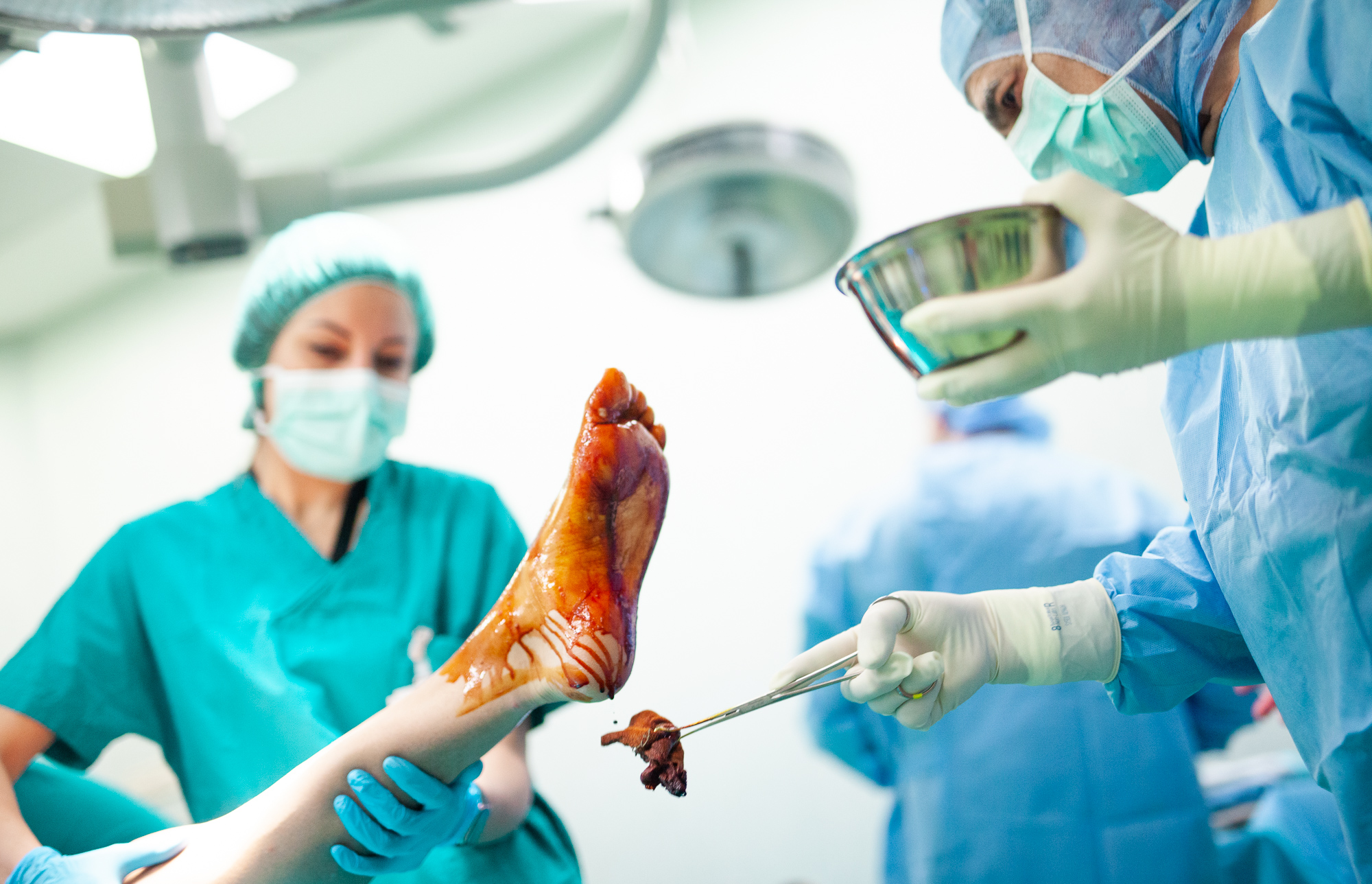 Chirurgia piede e caviglia, ortopedici in formazione da tutta Europa all’ASST Gaetano Pini-CTO